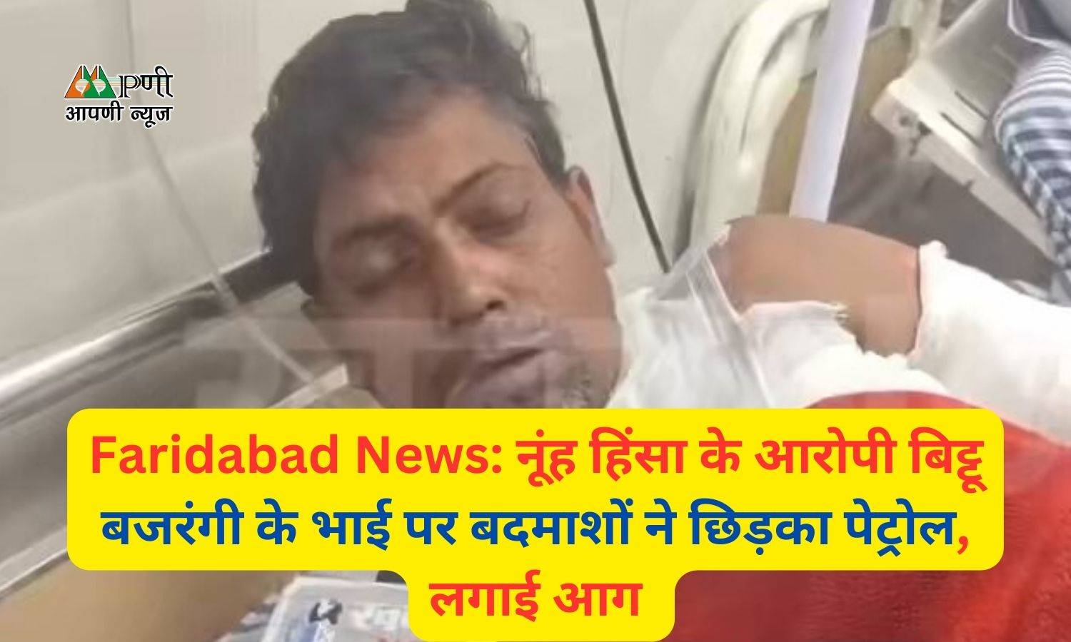 Faridabad News: नूंह हिंसा के आरोपी बिट्टू बजरंगी के भाई पर बदमाशों ने छिड़का पेट्रोल, लगाई आग