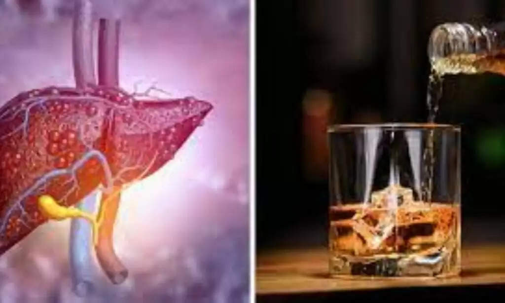 Alcohol Side Effects: लिवर को खत्म कर सकती है आपकी  शराब पीने की आदत, जानें इससे होने वाले अन्य गंभीर बीमारियाँ